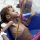 Photo of starving child in Yemen