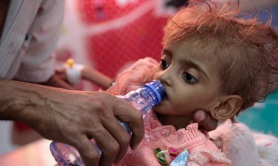 Photo of a hungry Yemeni child being fed.