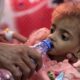 Photo of a hungry Yemeni child being fed.