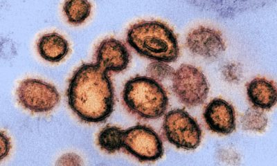 Photo of severe acute respiratory syndrome coronavirus 2, the virus that causes coronavirus disease 2019, isolated from a patient